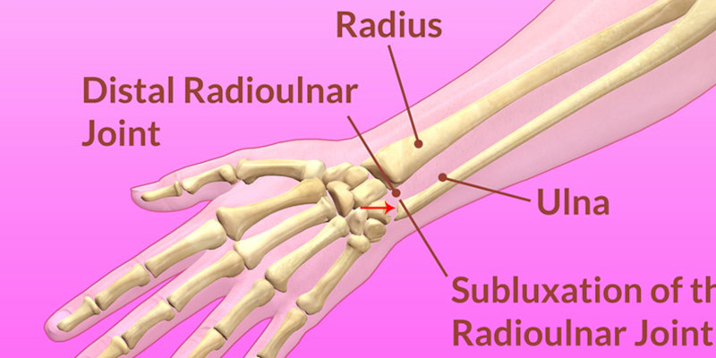 wrist-diagram
